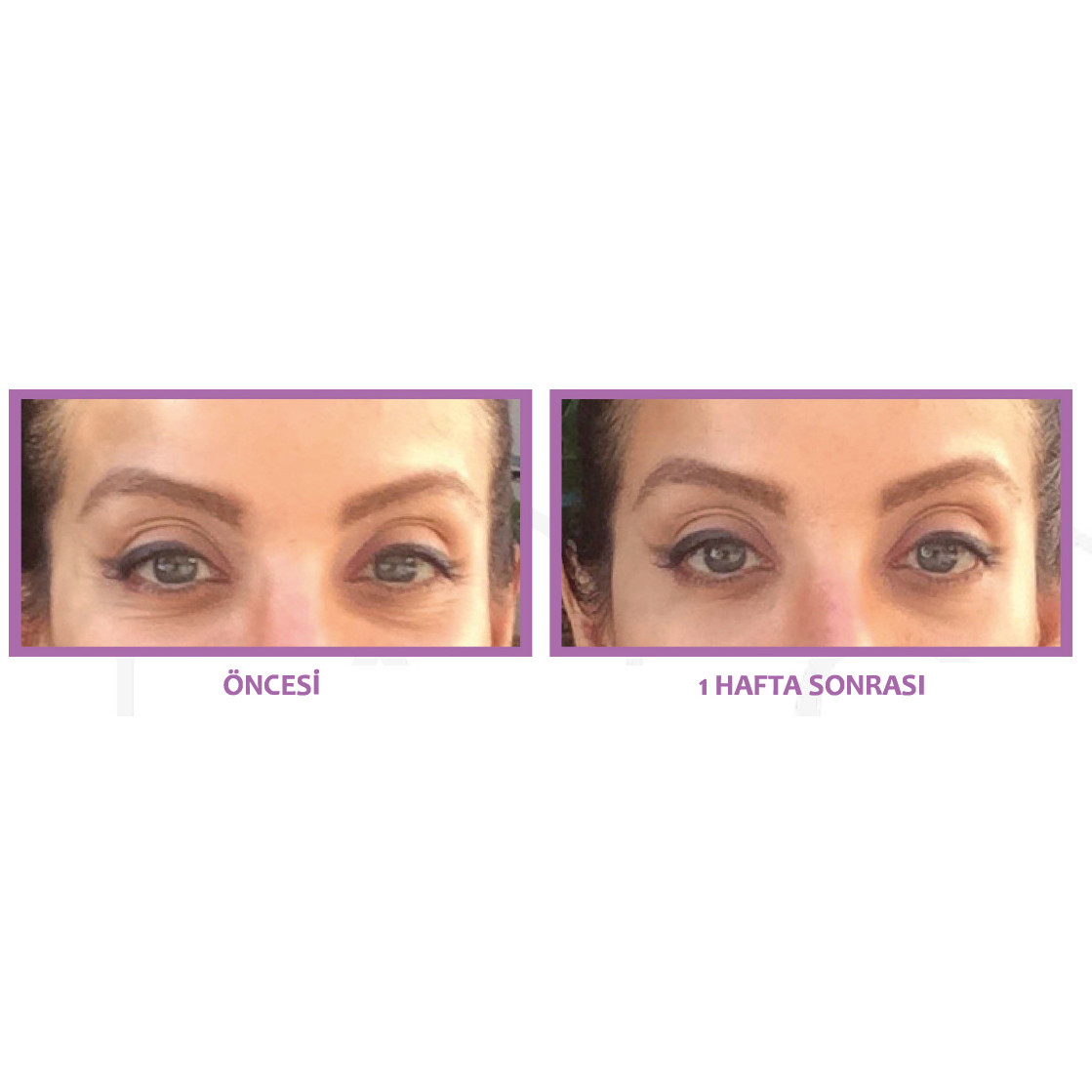 eye-serum-bottle-package-125-web.png